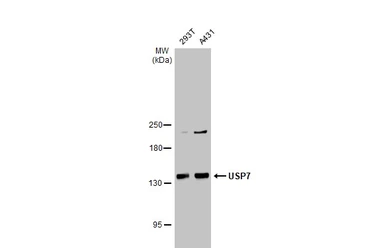 Anti-USP7 antibody used in Western Blot (WB). GTX125894