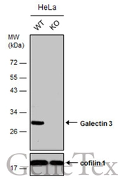 Anti-Galectin 3 antibody used in Western Blot (WB). GTX125897