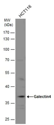 Anti-Galectin 4 antibody used in Western Blot (WB). GTX125898