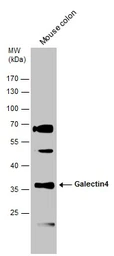 Anti-Galectin 4 antibody used in Western Blot (WB). GTX125898