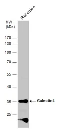 Anti-Galectin 4 antibody used in Western Blot (WB). GTX125898