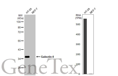 Anti-Galectin 4 antibody used in Western Blot (WB). GTX125898