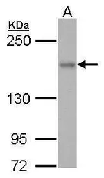 Anti-ROCK1 antibody used in Western Blot (WB). GTX125921