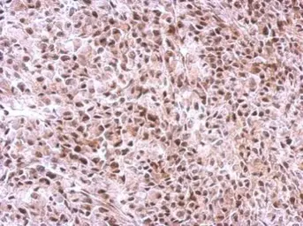 Anti-SLU7 antibody used in IHC (Paraffin sections) (IHC-P). GTX125935