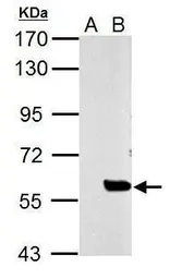 Anti-SLU7 antibody used in Western Blot (WB). GTX125935