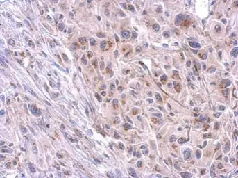 Anti-TTC39B antibody used in IHC (Paraffin sections) (IHC-P). GTX125938