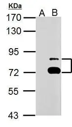 Anti-TTC39B antibody used in Western Blot (WB). GTX125938