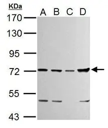 Anti-TTC39B antibody used in Western Blot (WB). GTX125938