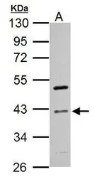 Anti-Cyclin I antibody used in Western Blot (WB). GTX125940