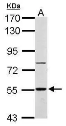 Anti-RAD26L antibody used in Western Blot (WB). GTX125943