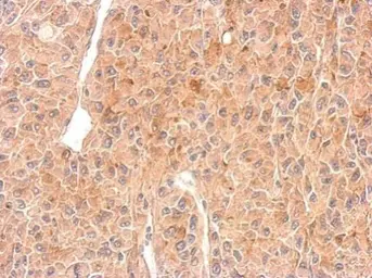 Anti-RAD26L antibody used in IHC (Paraffin sections) (IHC-P). GTX125944