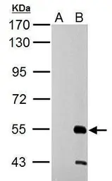 Anti-RAD26L antibody used in Western Blot (WB). GTX125944