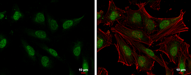 Anti-SLU7 antibody used in Immunocytochemistry/ Immunofluorescence (ICC/IF). GTX125955
