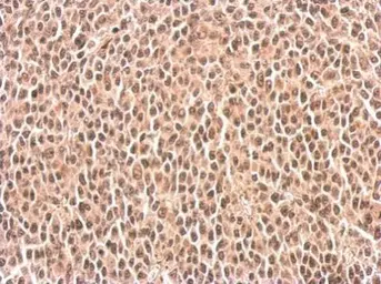 Anti-SLU7 antibody used in IHC (Paraffin sections) (IHC-P). GTX125955