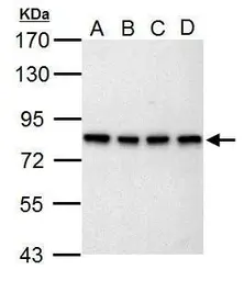 Anti-SLU7 antibody used in Western Blot (WB). GTX125955