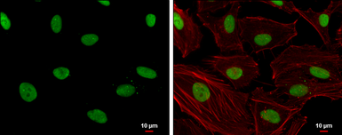 Anti-SLU7 (phospho Ser513/Ser515) antibody used in Immunocytochemistry/ Immunofluorescence (ICC/IF). GTX125960
