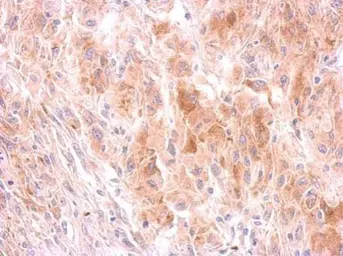Anti-GRB10 antibody used in IHC (Paraffin sections) (IHC-P). GTX125980