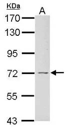 Anti-GRB10 antibody used in Western Blot (WB). GTX125982