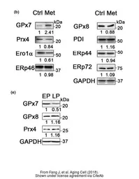 Anti-GPX8 antibody used in Western Blot (WB). GTX125992
