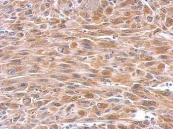 Anti-GPX8 antibody used in IHC (Paraffin sections) (IHC-P). GTX125992