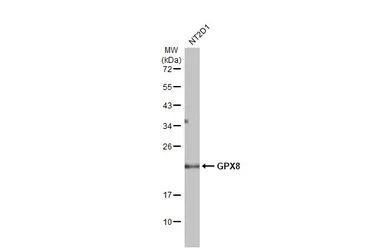 Anti-GPX8 antibody used in Western Blot (WB). GTX125992