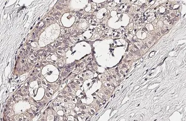 Anti-GPX8 antibody used in IHC (Paraffin sections) (IHC-P). GTX125992