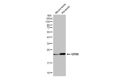 Anti-GPX8 antibody used in Western Blot (WB). GTX125992