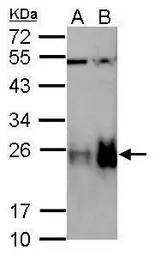 Anti-Tagln antibody used in Western Blot (WB). GTX125994