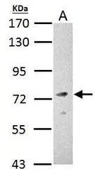 Anti-Fmr1 antibody used in Western Blot (WB). GTX125996