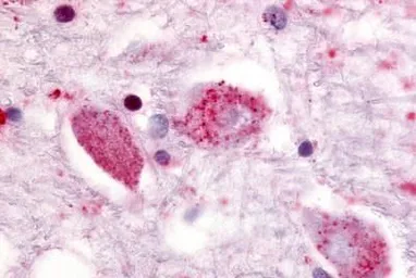 Anti-GPR85 antibody used in IHC (Paraffin sections) (IHC-P). GTX12600