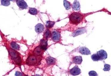 Anti-MCHR2 antibody used in Immunocytochemistry/ Immunofluorescence (ICC/IF). GTX12674