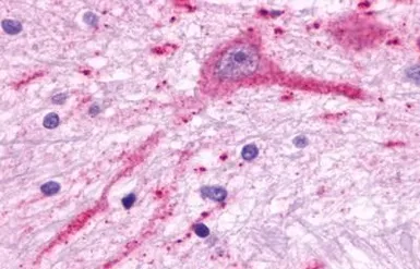 Anti-MCHR2 antibody used in IHC (Paraffin sections) (IHC-P). GTX12674