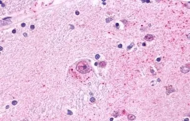 Anti-MCHR2 antibody used in IHC (Paraffin sections) (IHC-P). GTX12674