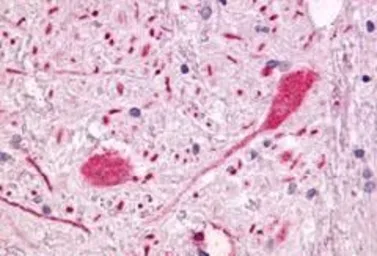 Anti-GPR55 antibody used in IHC (Paraffin sections) (IHC-P). GTX12700