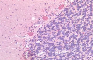 Anti-GPR87 antibody used in IHC (Paraffin sections) (IHC-P). GTX12709
