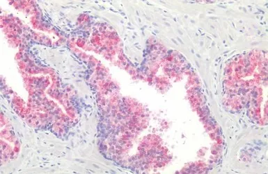 Anti-GPR87 antibody used in IHC (Paraffin sections) (IHC-P). GTX12709