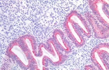 Anti-GPR87 antibody used in IHC (Paraffin sections) (IHC-P). GTX12709