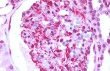 Anti-GPRC5B antibody used in IHC (Paraffin sections) (IHC-P). GTX12711