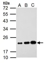 Anti-AICDA antibody used in Western Blot (WB). GTX127276