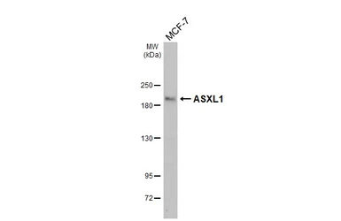 Anti-ASXL1 antibody used in Western Blot (WB). GTX127284