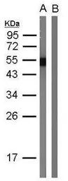 Anti-Protein A antibody used in Western Blot (WB). GTX127324