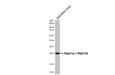 Anti-Rab11a + Rab11b antibody used in Western Blot (WB). GTX127328