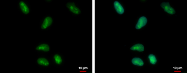 Anti-HMGB1 antibody used in Immunocytochemistry/ Immunofluorescence (ICC/IF). GTX127344