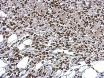 Anti-HMGB1 antibody used in IHC (Paraffin sections) (IHC-P). GTX127344