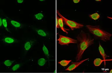Anti-HMGB1 antibody used in Immunocytochemistry/ Immunofluorescence (ICC/IF). GTX127344