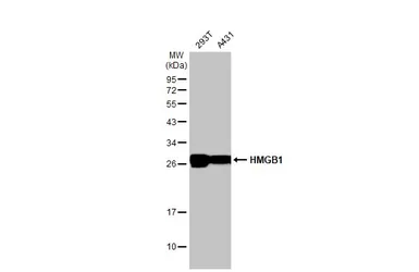 Anti-HMGB1 antibody used in Western Blot (WB). GTX127344
