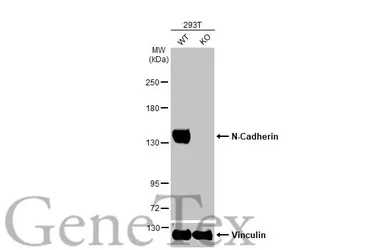 Anti-N-Cadherin antibody used in Western Blot (WB). GTX127345