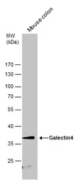 Anti-Galectin 4 antibody used in Western Blot (WB). GTX127351