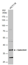 Anti-Galectin 4 antibody used in Western Blot (WB). GTX127351