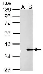 Anti-Galectin 4 antibody used in Western Blot (WB). GTX127351